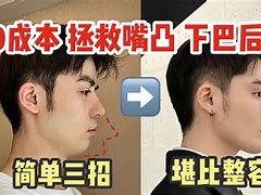 “后布太前發分黃前精