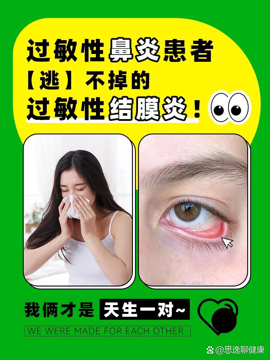 靈魂畫圖教教你怎么判斷兒童過敏性結(jié)膜炎