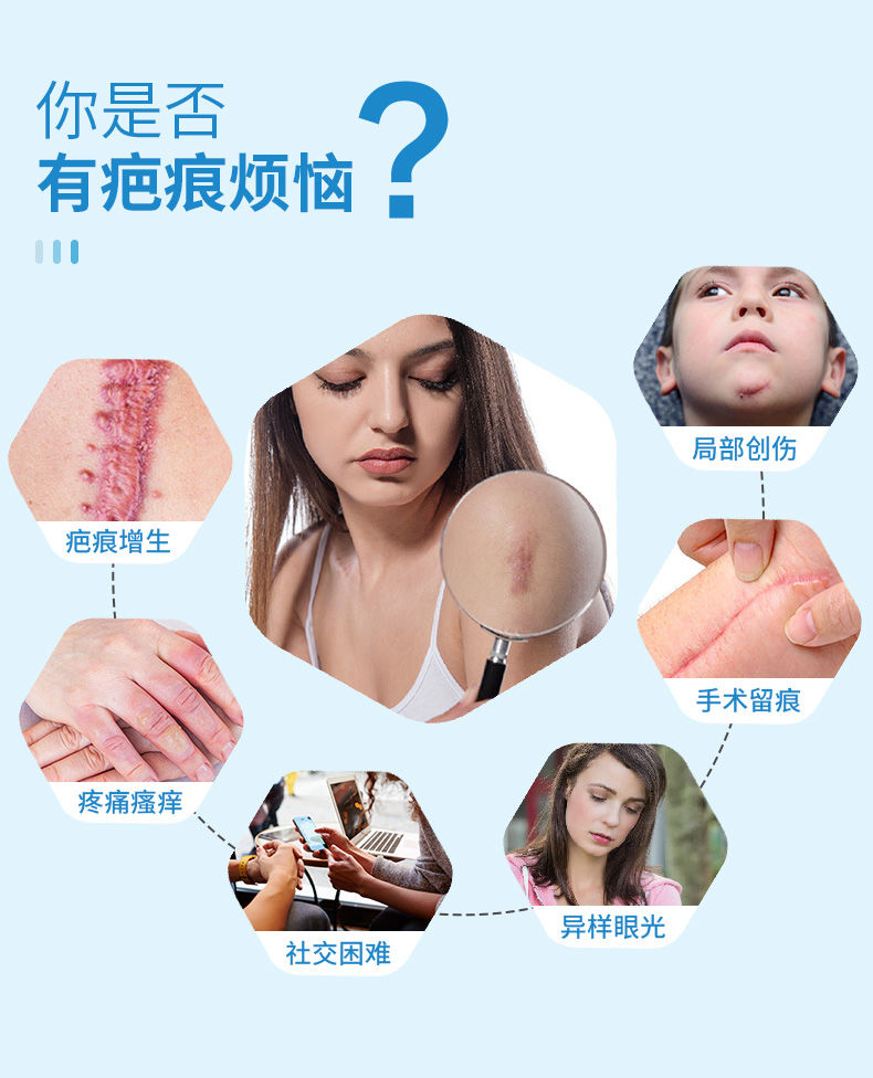 芭克到底有沒有生物作用?_祛疤產品