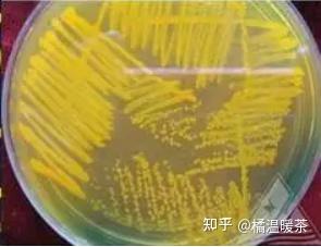 溶藻弧菌ELISA測定,弧菌免疫特性檢測,第三方檢測機構