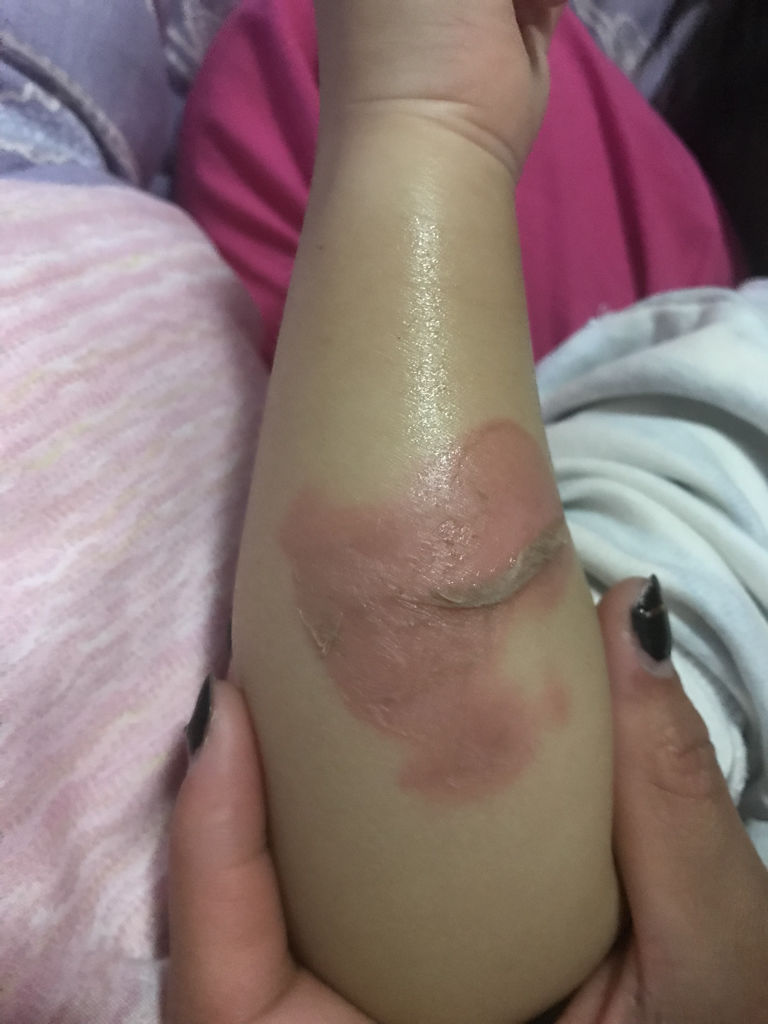 鵝卵石含甲醛嗎我家里放了很多,對小孩子有影響嗎