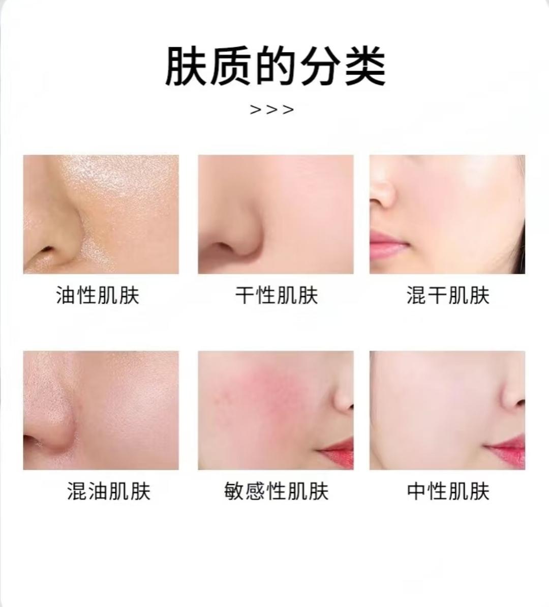 皮膚膚質有幾種