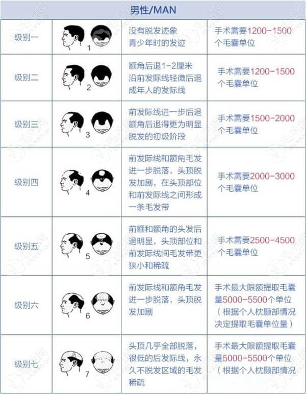 植發的最佳年齡